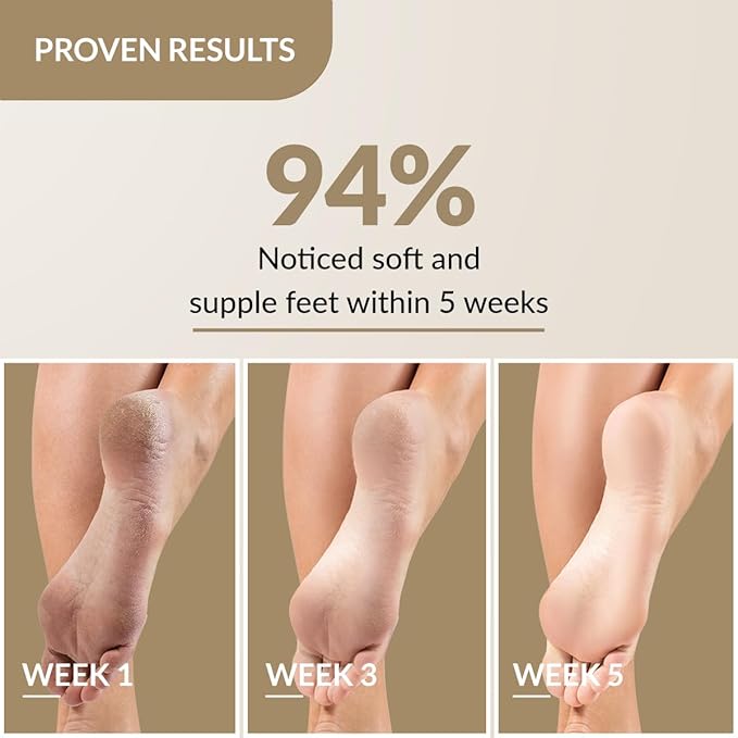 Fixderma Foobetik Cream, Foot cream, Foot Care For Diabetic, For Dry - Image 4