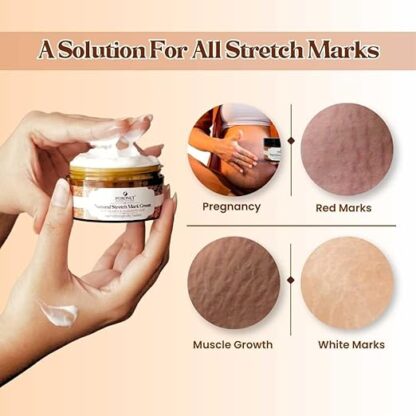 POKONUT - nurture with love Ayurvedic Stretch Mark Cream - Image 3