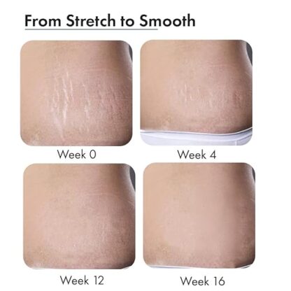 ThriveCo Stretch Marks Expert Serum Cream - Image 4
