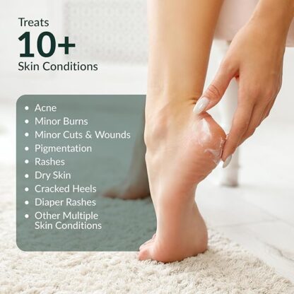 Mayaderm Multipurpose Herbal Cream - Image 3