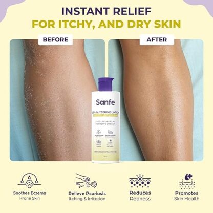 Sanfe 15% Glycerine Lotion - Image 2