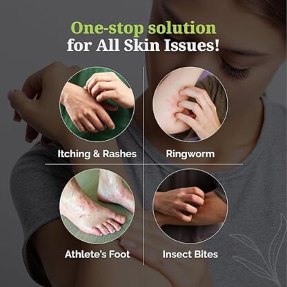 Itchstop® Anti-Fungal Spray | Hands Free - Image 5